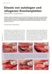 issueImage