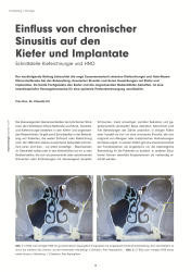 issueImage