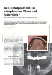 issueImage