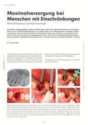 issueImage