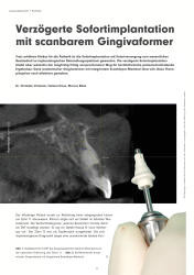 issueImage