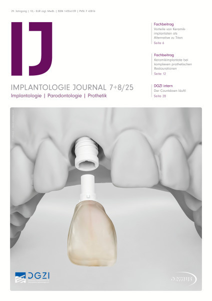 Implantologie Journal