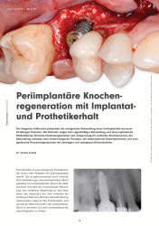issueImage