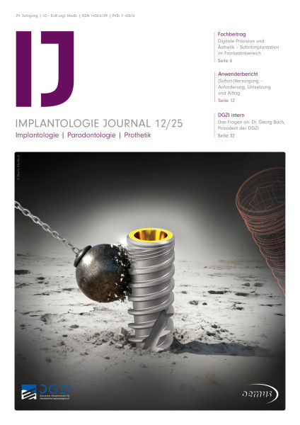 Implantologie Journal
