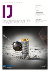 Implantologie Journal 12/2025