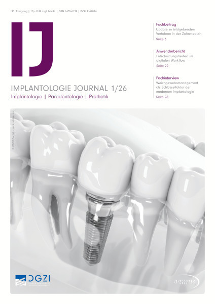 Implantologie Journal
