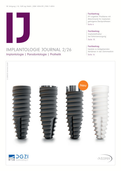 Implantologie journal