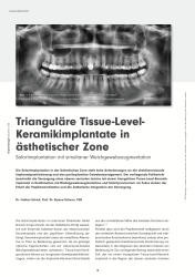 issueImage