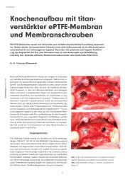 issueImage