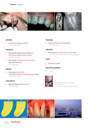 issueImage