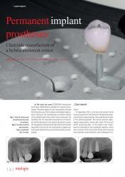 issueImage