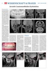 issueImage