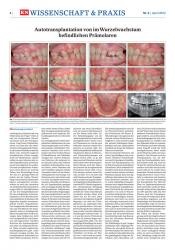 issueImage