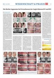 issueImage