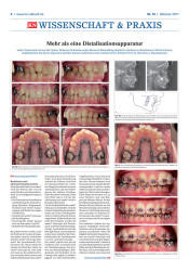 issueImage