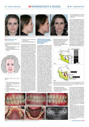 issueImage