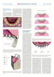 issueImage