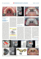 issueImage