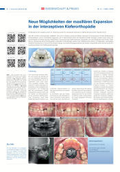 issueImage