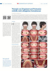 issueImage