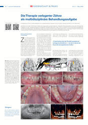 issueImage