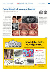 issueImage