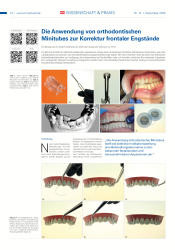 issueImage