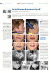 issueImage