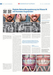 issueImage