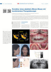 issueImage
