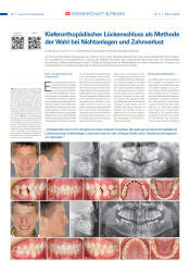 issueImage