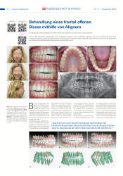 issueImage