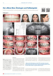 issueImage