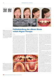 issueImage