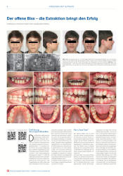 issueImage