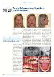 issueImage