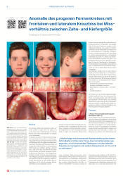 issueImage
