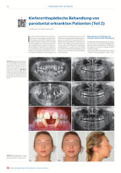 issueImage