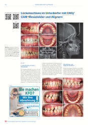 issueImage