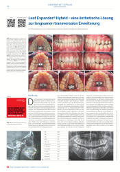 issueImage