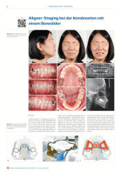 issueImage