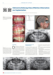 issueImage