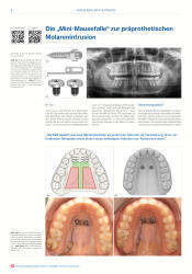 issueImage