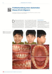 issueImage
