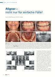 issueImage