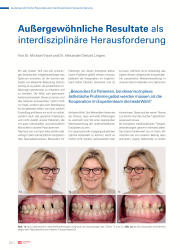 issueImage
