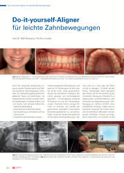 issueImage