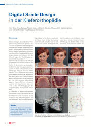 issueImage