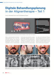 issueImage
