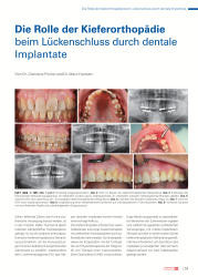 issueImage